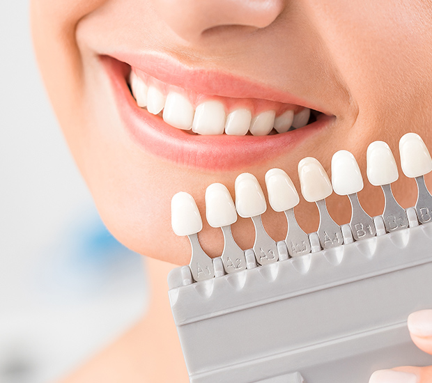 Simi Valley Dental Veneers and Dental Laminates