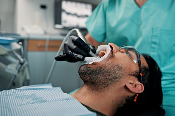 Common Cosmetic Dental Procedures In Full Mouth Reconstruction