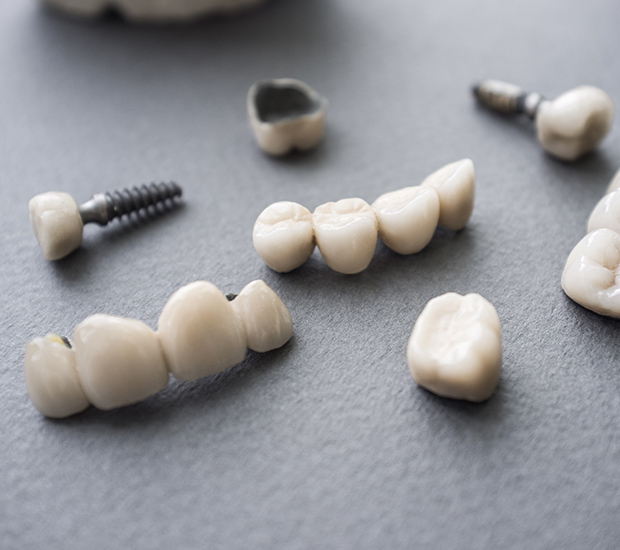 Simi Valley The Difference Between Dental Implants and Mini Dental Implants