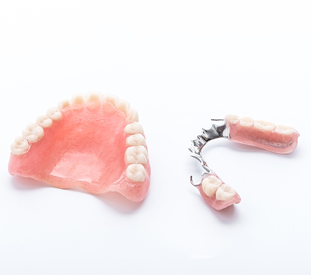 Simi Valley Partial Dentures for Back Teeth