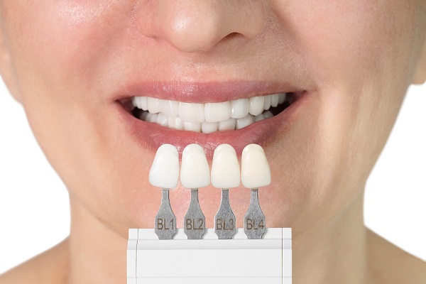 How Dental Veneers Can Boost Your Confidence