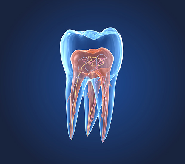 Simi Valley What is an Endodontist