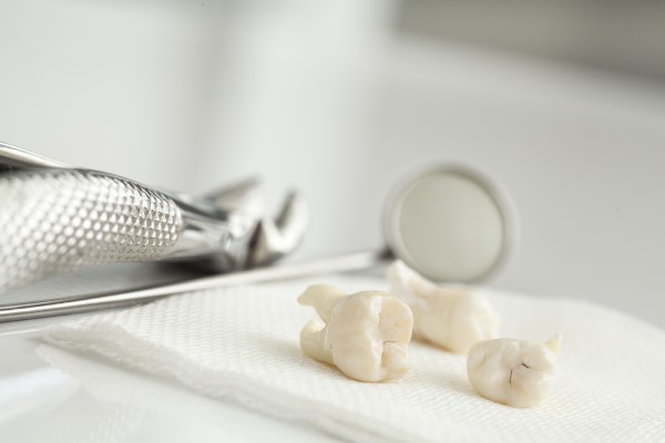 How To Recover From A Wisdom Tooth Extraction